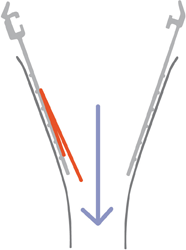Membrane stays open for easy access to contents.